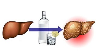 alkolün karaciğer üzerindeki etkileri